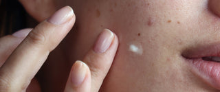 How to stack your way to brighter skin: the dark spot routine that works