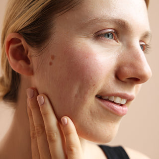 3-step starter set: acne prone skin