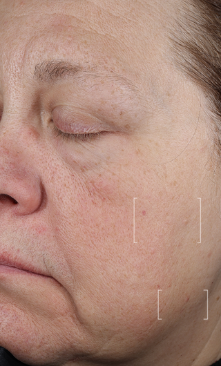 Close-up of a person's face with visible skin texture and lines.