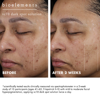 vc10 daily glow + vc10 dark spot solution bundle
