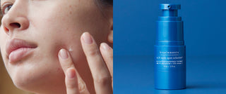 The 5 best ingredients for hyperpigmentation