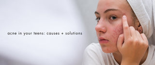 Acne in your teens: causes + solutions