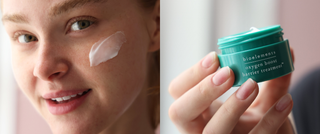 The skin barrier: what it is, why it matters, and how to support it