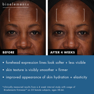 Before and after photos of 4 weeks using Firmwear.  Expression lines on the forehead look softer and less visible. The texture of the skin is visibly smoother and looks firmer.  There is an improved appearance of hydration and elasticity of the skin.  Results clinically measured from a 4 week interval study with usage of Bioelements Firmwear on 35 female subjects, ages 38-64.