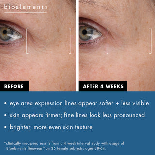 Before and after photos of 4 weeks using Firmwear. Expression lines around the eye area appear softer and less visible. The skin appears firmer with less pronounced fine lines. Skin is brighter and skin texture looks more even. Results clinically measured from a 4 week interval study with usage of Bioelements Firmwear on 35 female subjects, ages 38-64.